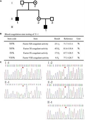 Case Report: Identification of a de novo Missense Mutation in the F8 Gene, p.(Phe690Leu)/c.2070C > A, Causing Hemophilia A: A Case Report